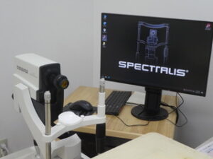 光干渉断層計（OCT）